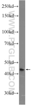 Thumbnail_FAM71F2 Rabbit anti-Human, Mouse, Polyclonal, Proteintech 150 &mu;L; Unconjugated:Antibodies,