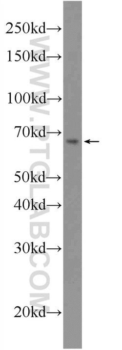 LARGE Rabbit anti-Human, Mouse, Polyclonal, Proteintech 150 &mu;L; Unconjugated:Antibodies,