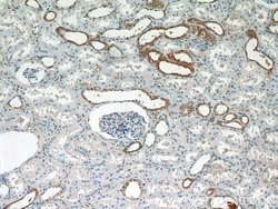 SGLT3/SLC5A4 Rabbit anti-Human, Mouse, Rat, Polyclonal, Proteintech:Antibodies:Primary