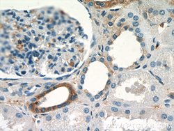 SGLT3/SLC5A4 Rabbit anti-Human, Mouse, Rat, Polyclonal, Proteintech:Antibodies:Primary