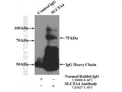 SGLT3/SLC5A4 Rabbit anti-Human, Mouse, Rat, Polyclonal, Proteintech:Antibodies:Primary