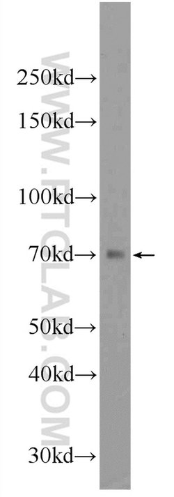 SGLT3/SLC5A4 Rabbit anti-Human, Mouse, Rat, Polyclonal, Proteintech:Antibodies:Primary