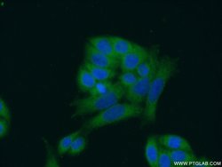 ANKRD16 Rabbit anti-Human, Mouse, Polyclonal, Proteintech 150 &mu;L; Unconjugated:Antibodies,