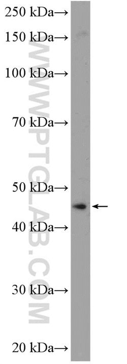 ANKRD16 Rabbit anti-Human, Mouse, Polyclonal, Proteintech 150 &mu;L; Unconjugated:Antibodies,