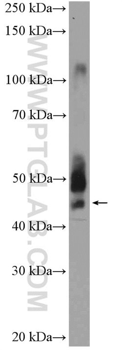 ANKRD16 Rabbit anti-Human, Mouse, Polyclonal, Proteintech 150 &mu;L; Unconjugated:Antibodies,