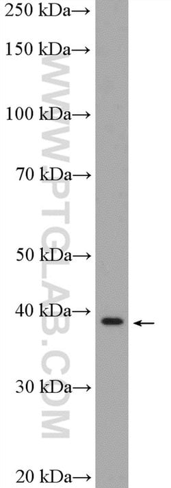 ANKRD16 Rabbit anti-Human, Mouse, Polyclonal, Proteintech 150 &mu;L; Unconjugated:Antibodies,
