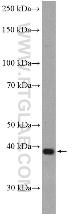 ANKRD16 Rabbit anti-Human, Mouse, Polyclonal, Proteintech 150 &mu;L; Unconjugated:Antibodies,