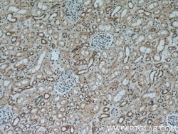 AQR Rabbit anti-Human, Polyclonal, Proteintech 150 &mu;L; Unconjugated:Antibodies,