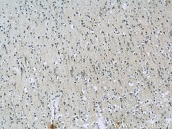 AQR Rabbit anti-Human, Polyclonal, Proteintech 150 &mu;L; Unconjugated:Antibodies,