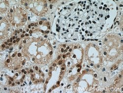 AQR Rabbit anti-Human, Polyclonal, Proteintech 150 &mu;L; Unconjugated:Antibodies,
