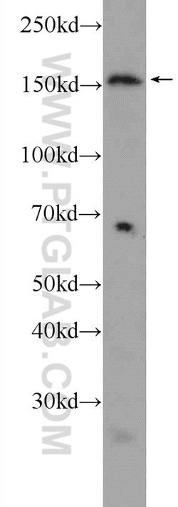 AQR Rabbit anti-Human, Polyclonal, Proteintech 150 &mu;L; Unconjugated:Antibodies,