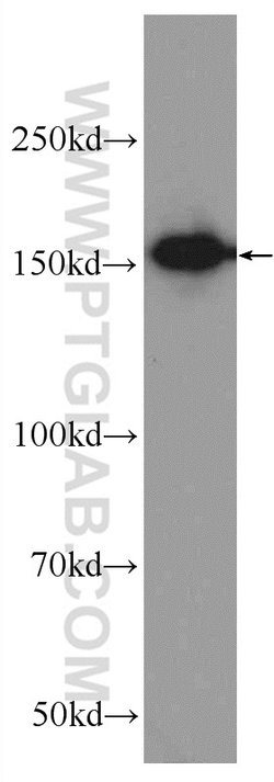 AQR Rabbit anti-Human, Polyclonal, Proteintech 150 &mu;L; Unconjugated:Antibodies,