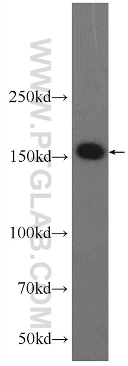 AQR Rabbit anti-Human, Polyclonal, Proteintech 150 &mu;L; Unconjugated:Antibodies,