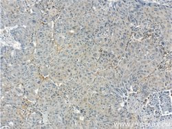 GPATCH2 Rabbit anti-Human, Mouse, Polyclonal, Proteintech 150 &mu;L; Unconjugated:Antibodies,