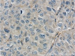 GPATCH2 Rabbit anti-Human, Mouse, Polyclonal, Proteintech 150 &mu;L; Unconjugated:Antibodies,