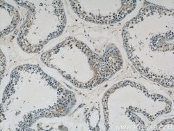 GPATCH2 Rabbit anti-Human, Mouse, Polyclonal, Proteintech 150 &mu;L; Unconjugated:Antibodies,