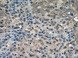 GPATCH2 Rabbit anti-Human, Mouse, Polyclonal, Proteintech 150 &mu;L; Unconjugated:Antibodies,