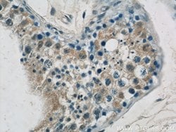 GPATCH2 Rabbit anti-Human, Mouse, Polyclonal, Proteintech 150 &mu;L; Unconjugated:Antibodies,