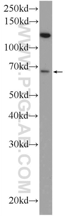 GPATCH2 Rabbit anti-Human, Mouse, Polyclonal, Proteintech 150 &mu;L; Unconjugated:Antibodies,