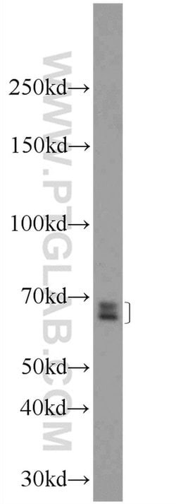GPATCH2 Rabbit anti-Human, Mouse, Polyclonal, Proteintech 150 &mu;L; Unconjugated:Antibodies,