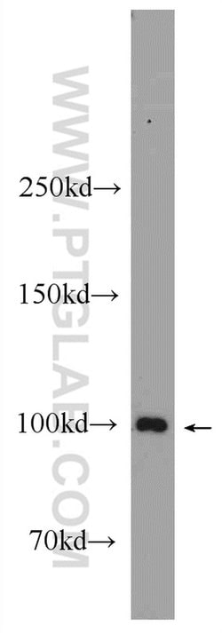ACTN3 Rabbit anti-Human, Mouse, Polyclonal, Proteintech 150 &mu;L; Unconjugated:Anticuerpos