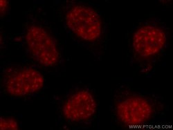 C17orf85 Rabbit anti-Human, Polyclonal, Proteintech 150 &mu;L; Unconjugated:Antibodies,