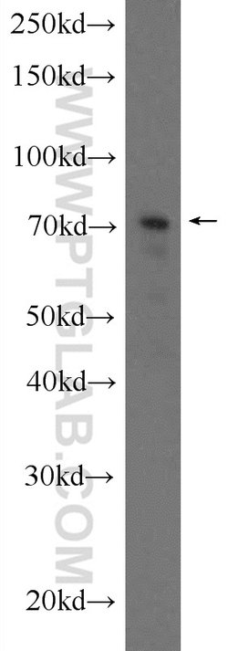 C17orf85 Rabbit anti-Human, Polyclonal, Proteintech 150 &mu;L; Unconjugated:Antibodies,