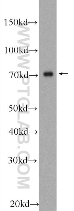 C17orf85 Rabbit anti-Human, Polyclonal, Proteintech 150 &mu;L; Unconjugated:Antibodies,