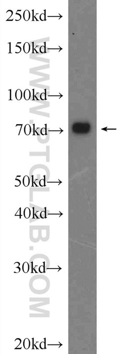 C17orf85 Rabbit anti-Human, Polyclonal, Proteintech 150 &mu;L; Unconjugated:Antibodies,