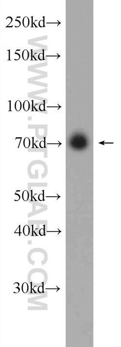 C17orf85 Rabbit anti-Human, Polyclonal, Proteintech 150 &mu;L; Unconjugated:Antibodies,