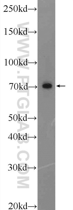 C17orf85 Rabbit anti-Human, Polyclonal, Proteintech 150 &mu;L; Unconjugated:Antibodies,