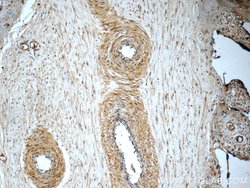 PERK/EIF2AK3 Rabbit anti-Human, Polyclonal, Proteintech:Antibodies:Primary