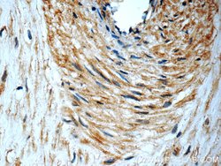 PERK/EIF2AK3 Rabbit anti-Human, Polyclonal, Proteintech:Antibodies:Primary