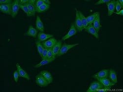 PERK/EIF2AK3 Rabbit anti-Human, Polyclonal, Proteintech:Antibodies:Primary