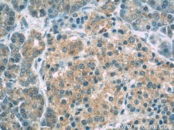 PERK/EIF2AK3 Rabbit anti-Human, Polyclonal, Proteintech:Antibodies:Primary