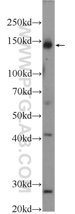 PERK/EIF2AK3 Rabbit anti-Human, Polyclonal, Proteintech:Antibodies:Primary
