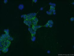 GPATCH4 Rabbit anti-Human, Mouse, Rat, Polyclonal, Proteintech 150 &mu;L;