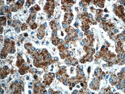 GPATCH4 Rabbit anti-Human, Mouse, Rat, Polyclonal, Proteintech 150 &mu;L;