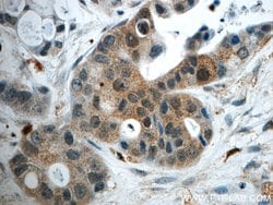 GPATCH4 Rabbit anti-Human, Mouse, Rat, Polyclonal, Proteintech 150 &mu;L;