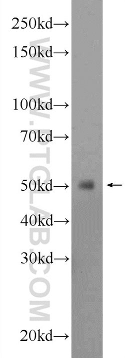 GPATCH4 Rabbit anti-Human, Mouse, Rat, Polyclonal, Proteintech 150 &mu;L;