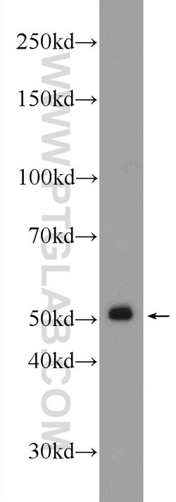 GPATCH4 Rabbit anti-Human, Mouse, Rat, Polyclonal, Proteintech 150 &mu;L;
