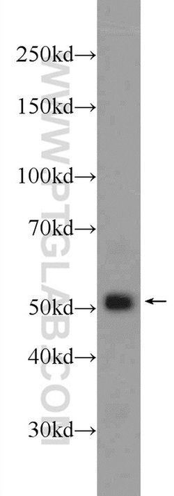 GPATCH4 Rabbit anti-Human, Mouse, Rat, Polyclonal, Proteintech 150 &mu;L;