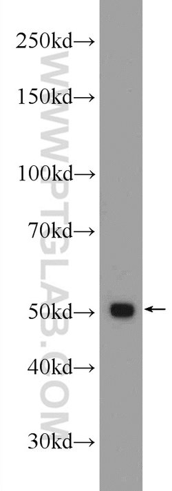 GPATCH4 Rabbit anti-Human, Mouse, Rat, Polyclonal, Proteintech 150 &mu;L;