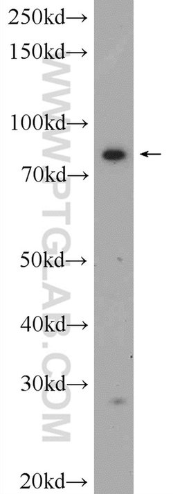 FAM48A Rabbit anti-Human, Polyclonal, Proteintech 20 &mu;L | Buy Online | Proteintech | Fisher Scientific