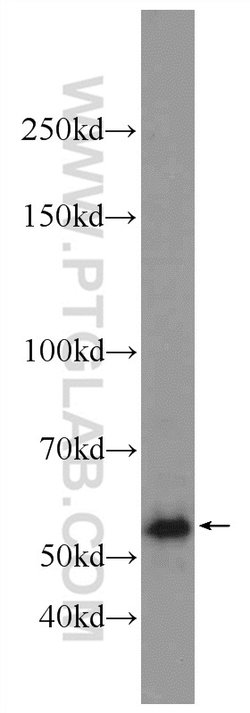 MPND Rabbit anti-Human, Mouse, Polyclonal, Proteintech:Antibodies:Primary