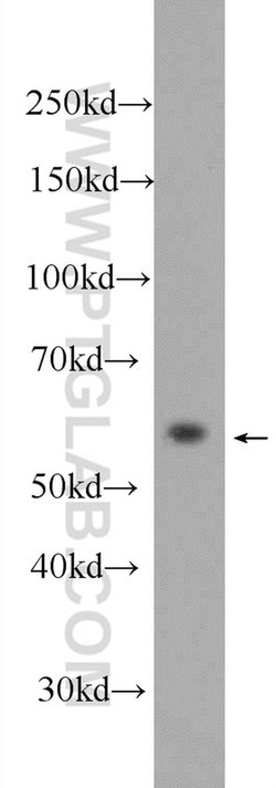MPND Rabbit anti-Human, Mouse, Polyclonal, Proteintech:Antibodies:Primary