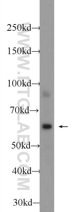 MPND Rabbit anti-Human, Mouse, Polyclonal, Proteintech:Antibodies:Primary