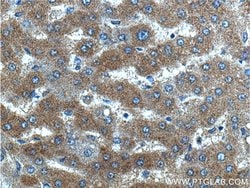 WDR7 Rabbit anti-Human, Mouse, Rat, Polyclonal, Proteintech 150 &mu;L | Buy Online | Proteintech Group Inc | Fisher Scientific