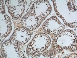 WDR7 Rabbit anti-Human, Mouse, Rat, Polyclonal, Proteintech 150 &mu;L | Buy Online | Proteintech Group Inc | Fisher Scientific