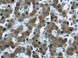 WDR7 Rabbit anti-Human, Mouse, Rat, Polyclonal, Proteintech 150 &mu;L | Buy Online | Proteintech Group Inc | Fisher Scientific